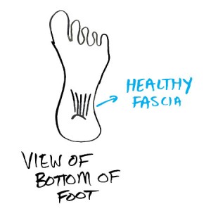 healthy-plantar-fascia