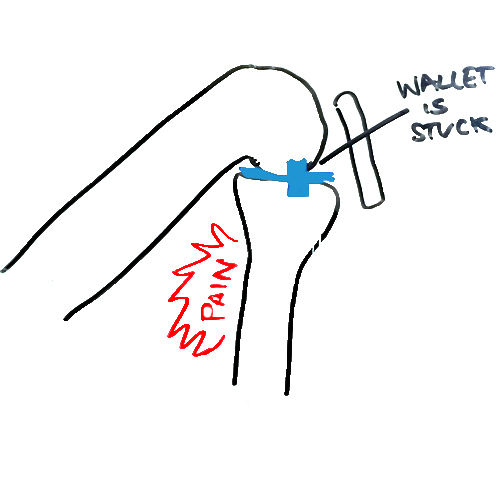 pain-with-knee-flexion