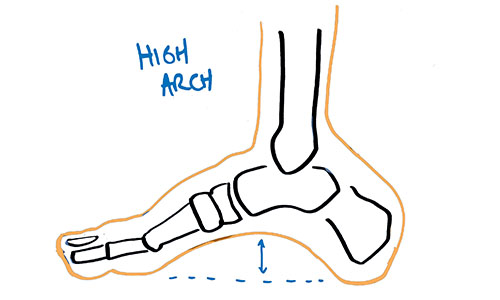 high-arch-position