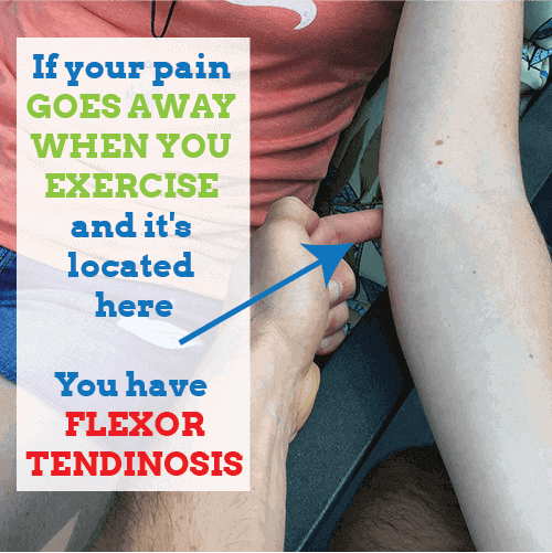 elbow-flexor-tendinosis