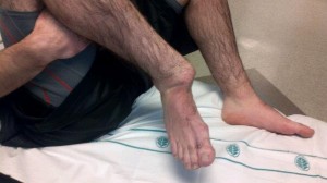 Ankle injury