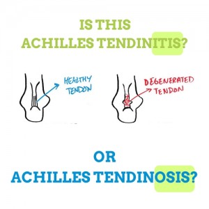 achilles-tendinitis-or-achilles-tendinosis