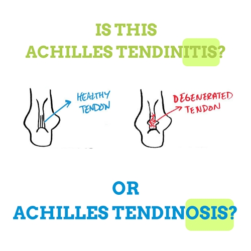 achilles-tendinitis-or-achilles-tendinosis