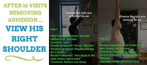 frozen-shoulder-flexibility-change