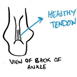 healthy-achilles-tendon