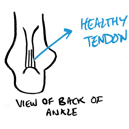 healthy-achilles-tendon