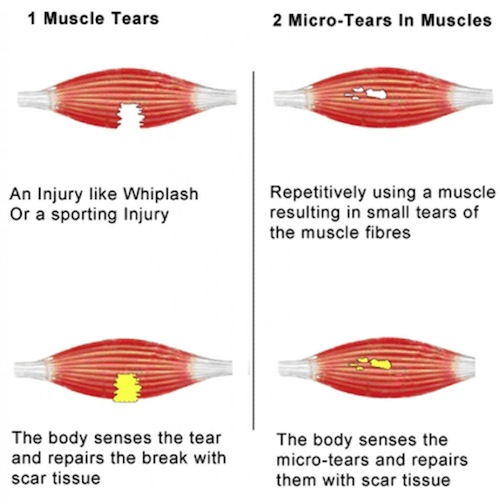 how-adhesion-forms