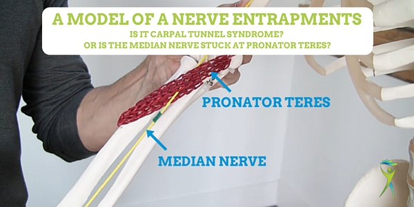 NERVE-ENTRAPMENT