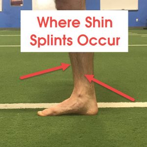 where-does-shin-splints-occur