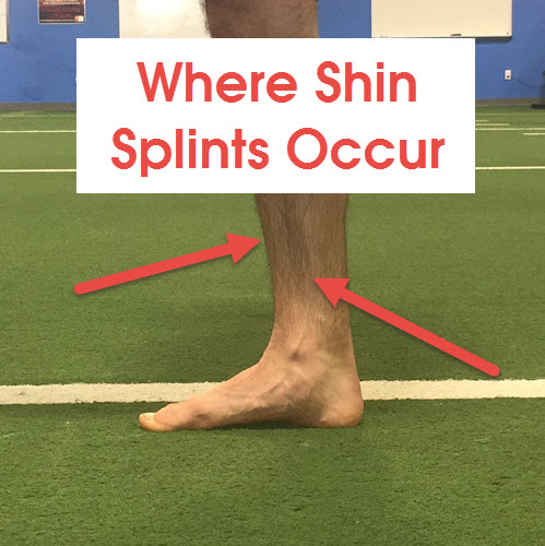 Shin Splint Treatment: How Improving Calf Strength Can Fix Your Shin  Splints - Runners Connect