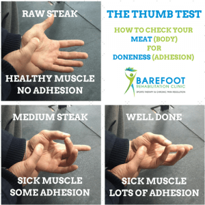 thumb-test-for-adhesion-low-back-pain-treatment