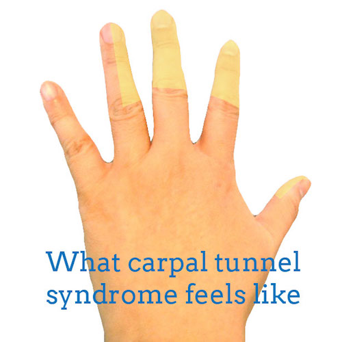 carpal-tunnel-syndrome-back-hand