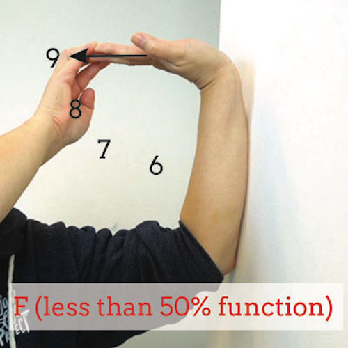 failing-wrist-extension-test