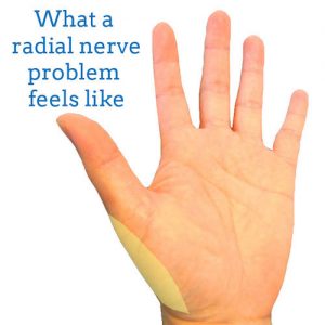 radial-nerve-front-hand