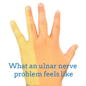 ulnar-nerve-back-hand