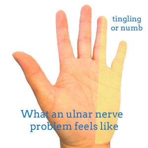 ulnar-nerve-front-hand