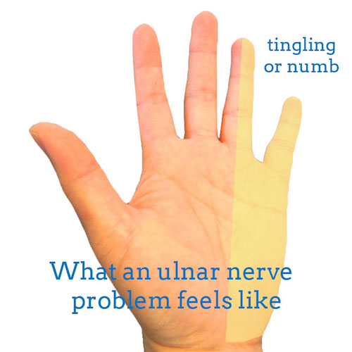 ulnar-nerve-front-hand