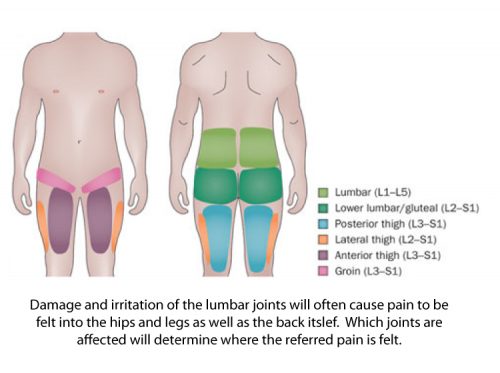 What does sacroiliac joint pain feel like?