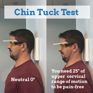 cervical-discography-chin-tuck-test