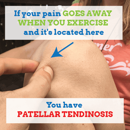 patellar-tendinosis