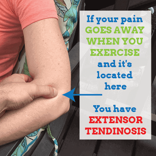 extensor-tendinosis