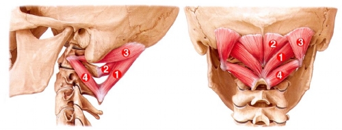 headache-upper-cervical-muscles