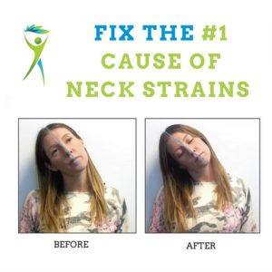 Neck-Strain-Treatment