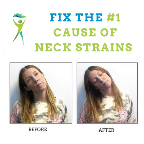 Neck-Strain-Treatment