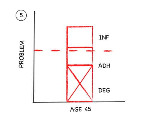 pain-threshold-5