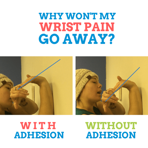 Wrist-Pain