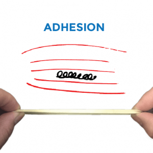 treating-adhesion