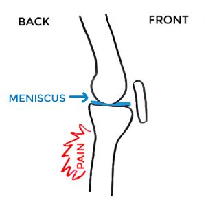 meniscus