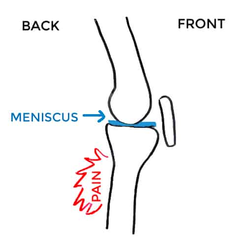 meniscus