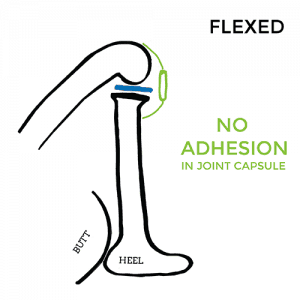pain-on-inside-of-knee-Flexed-no-adhesion