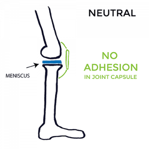 pain-on-inside-of-knee-Neutral-no-adhesion