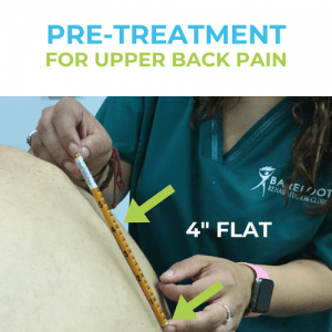 Upper-back-pain-PRE-treatment