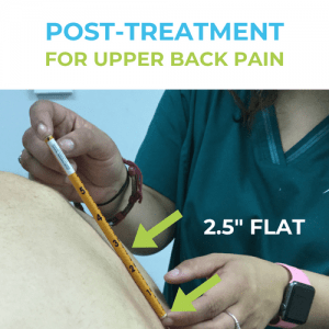 Upper-back-pain-pOST-treatment