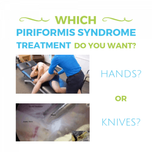 Piriformis-Syndrome-Treatment