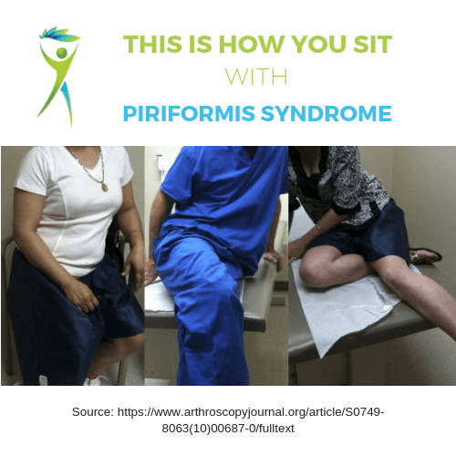 How to Correctly Treat Piriformis Syndrome – Squat University