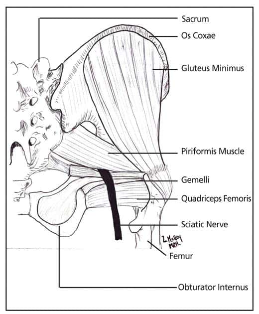 Piriformis Syndrome  Florida Orthopaedic Institute