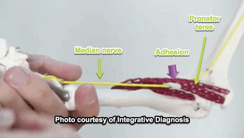 median-nerve-model