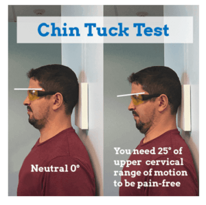 chin tuck test for stress tension headaches